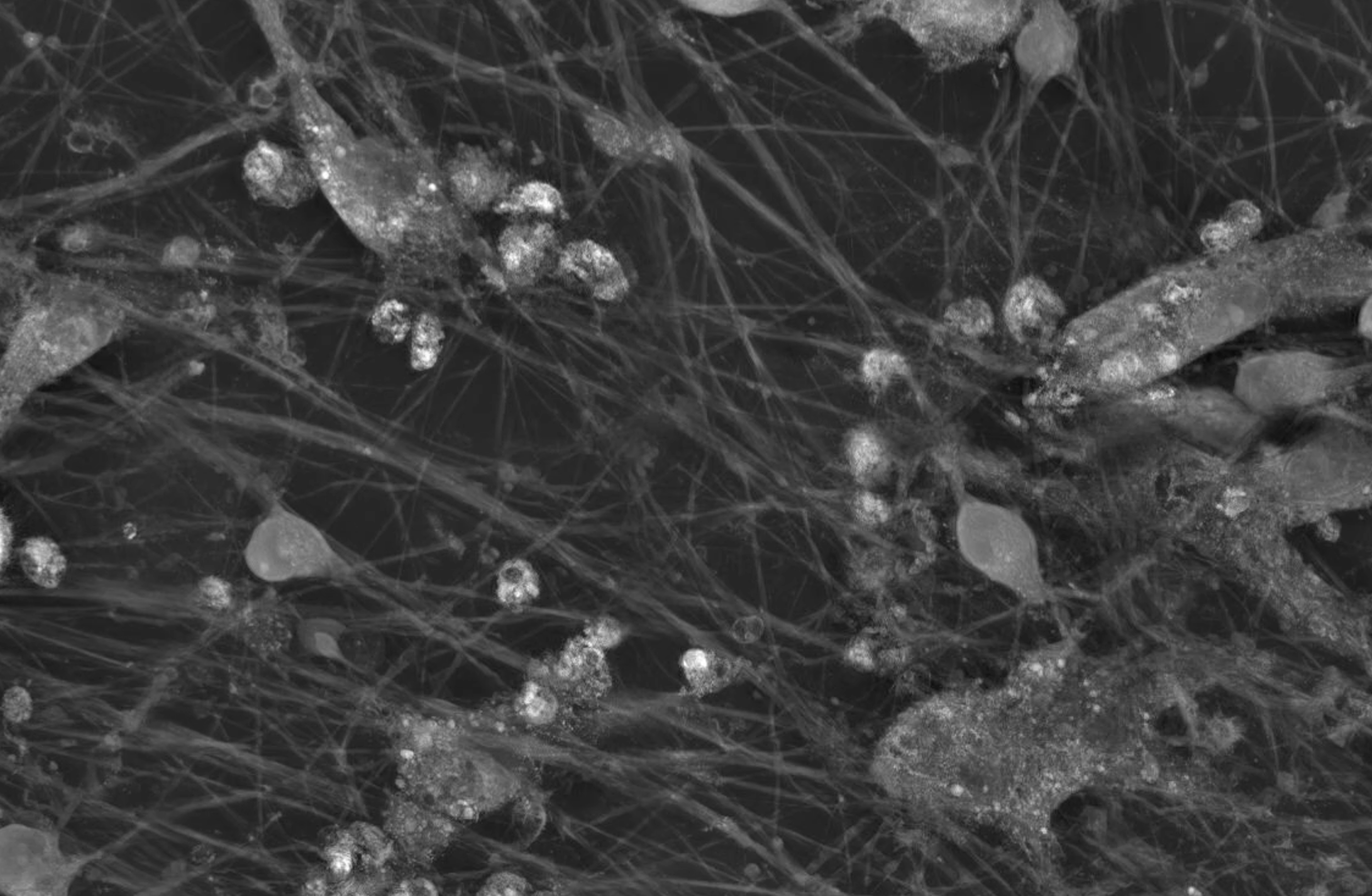 bit.bio-co-culture-neurons-and-microglia