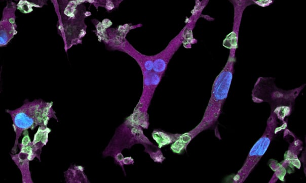 Morphology guide | ioMicroglia | bit.bio