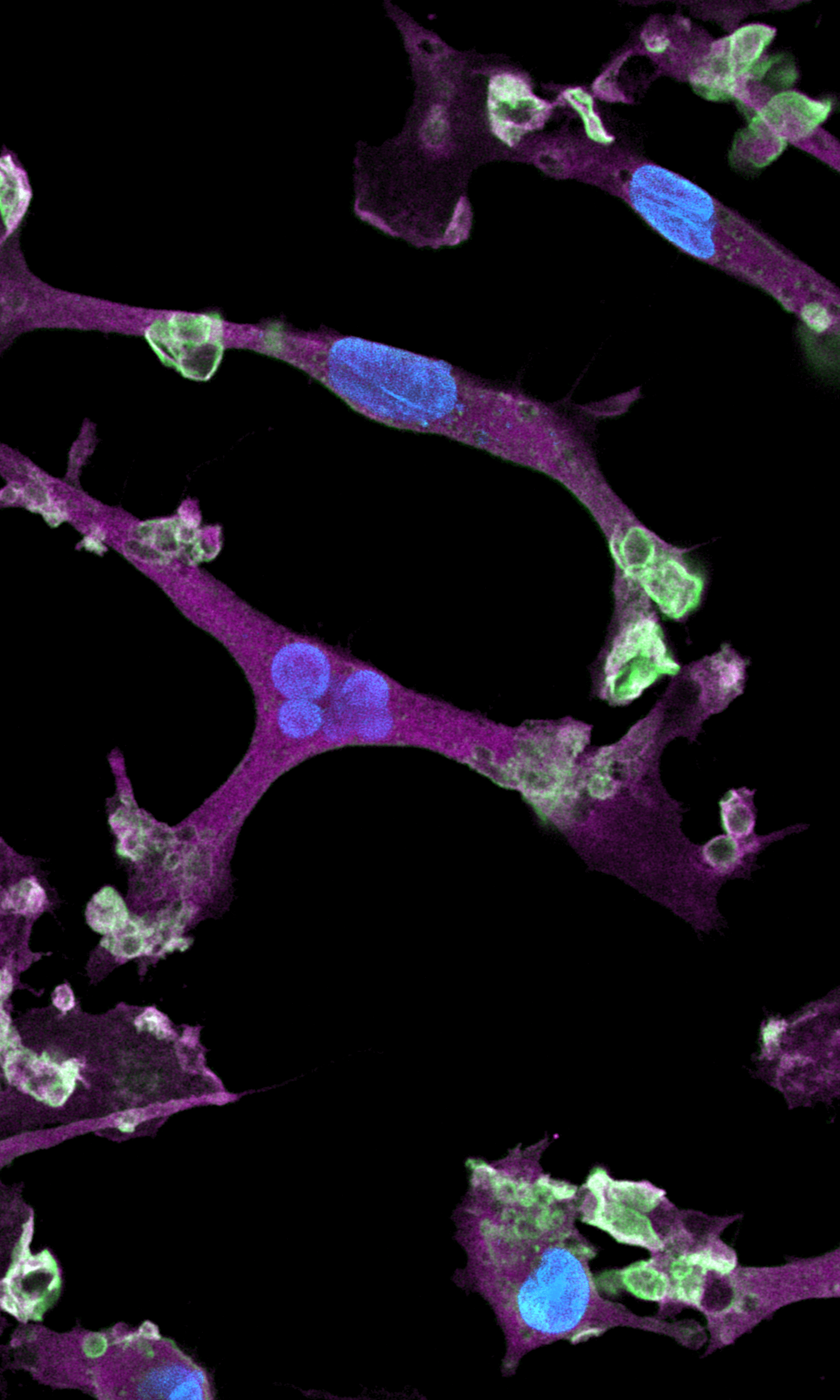 Female human iPSC donor-derived microglia for pre-clinical studies