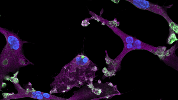 mRNA transfection of ioMicroglia