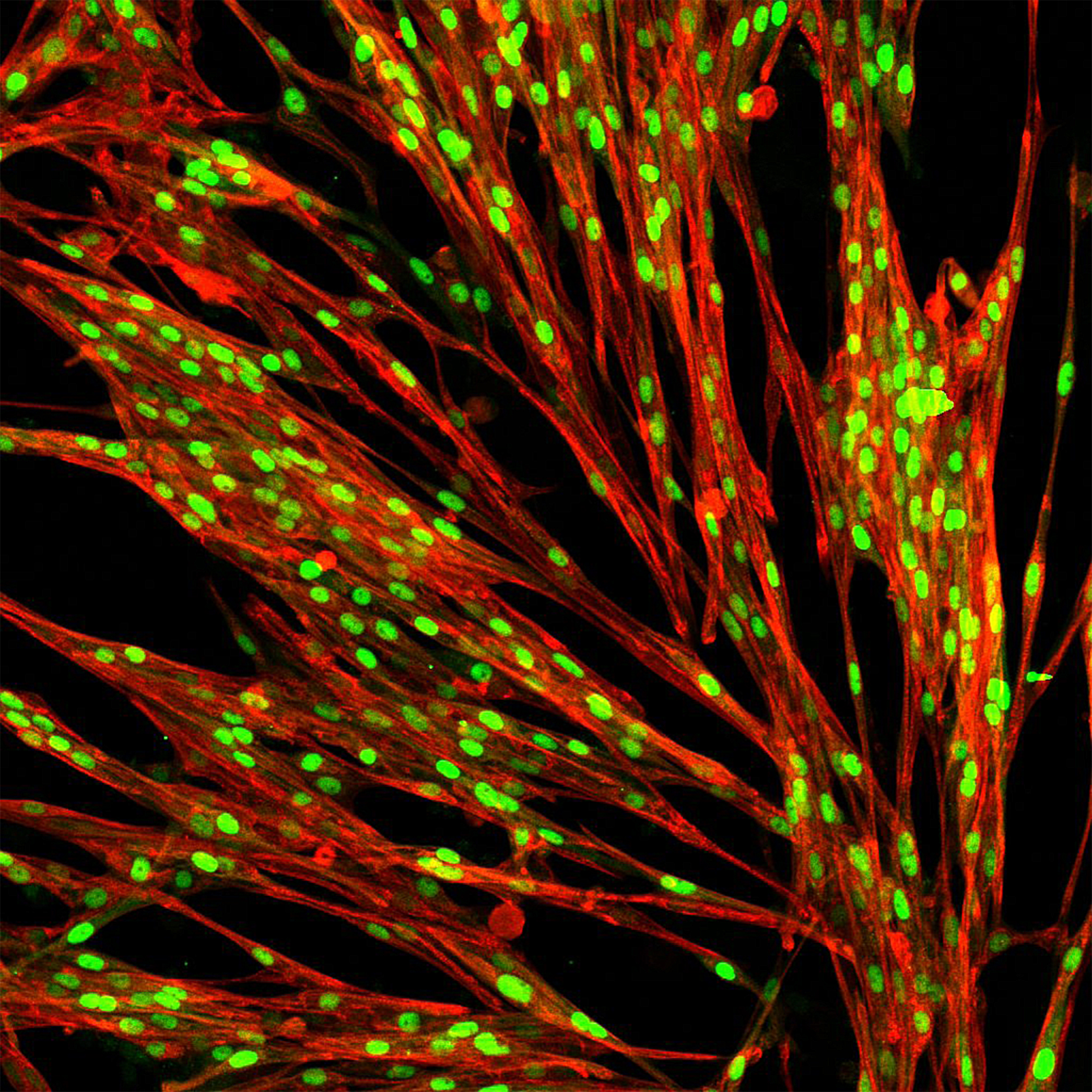 ioSkeletal Myocytes
