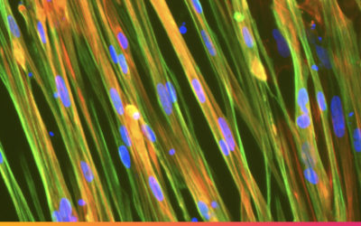 Introducing human iPSC derived muscle cells for research and drug discovery