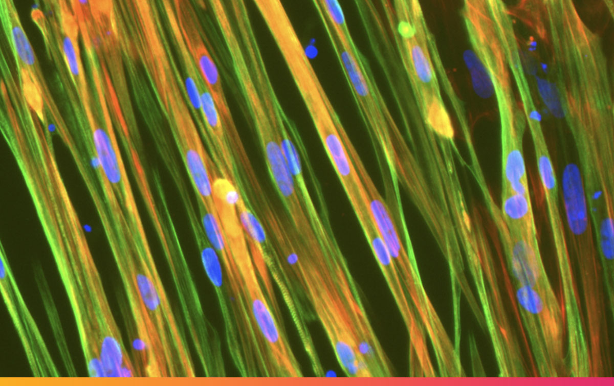 Introducing human iPSC derived muscle cells for research and drug discovery