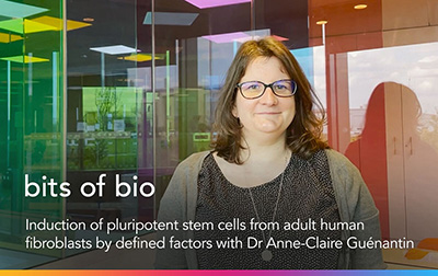 Induction of pluripotent stem cells from adult human fibroblasts by defined factors