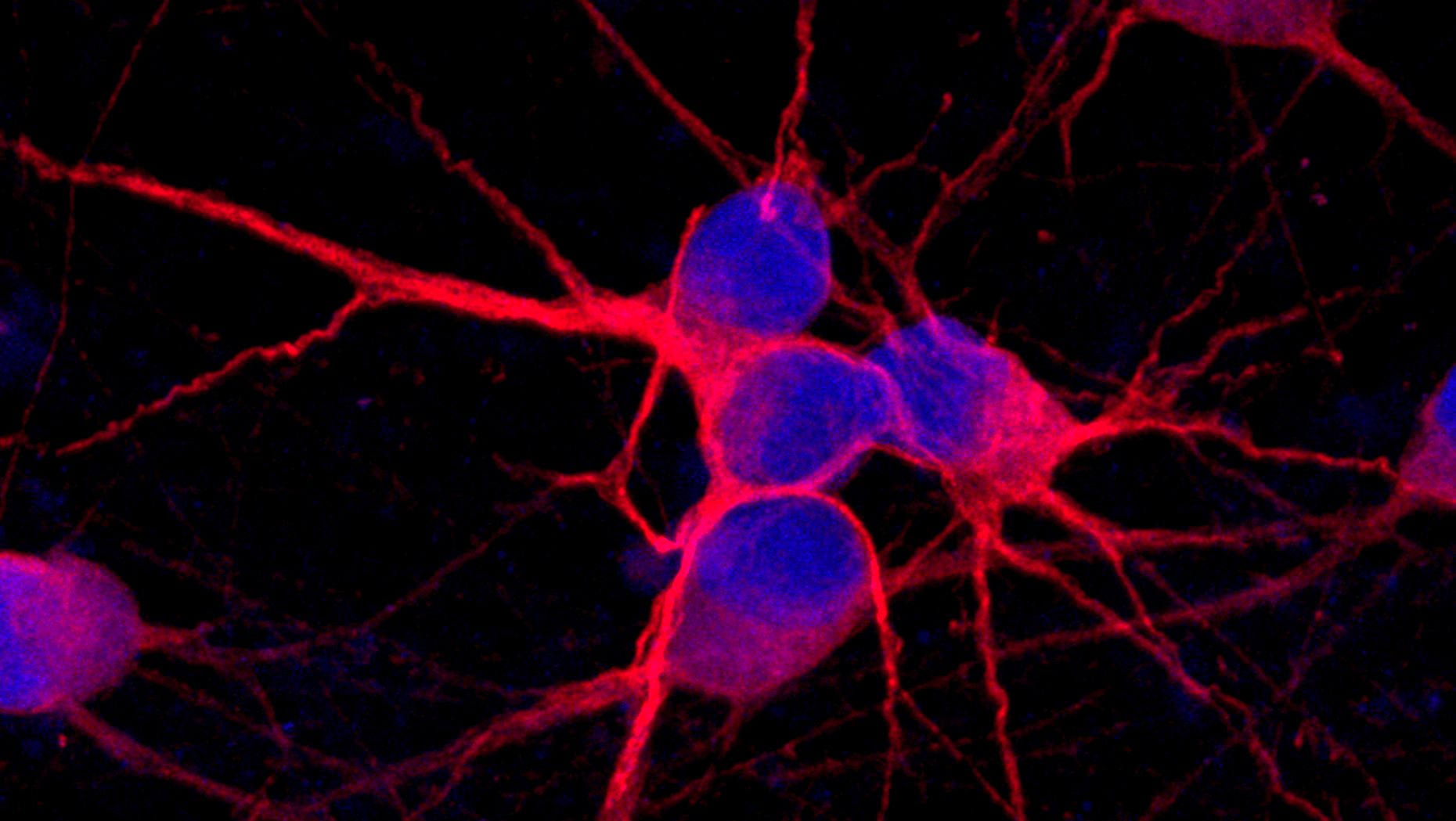 ioGlutamatergic Neurons in a network, coloured with immunocytochemistry