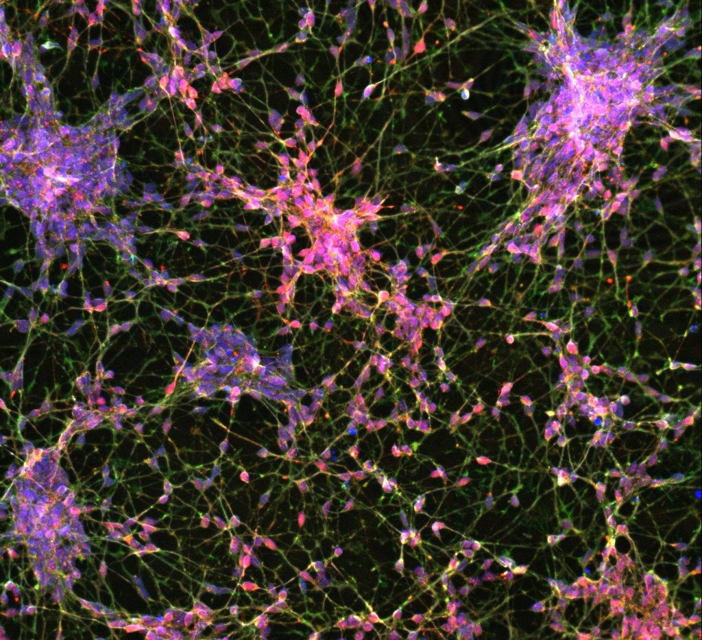 ioGABAergic Neurons