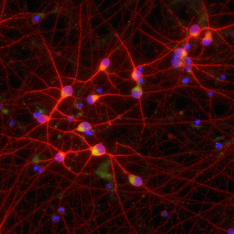 ioGlutamatergic Neurons TDP-43 M337V/WT