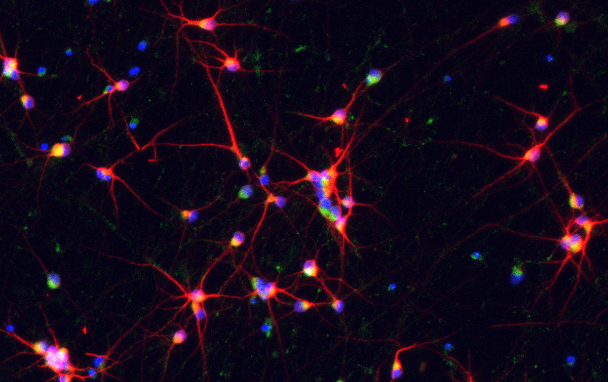 Scalable, reproducible platform for reprogrammed human cells