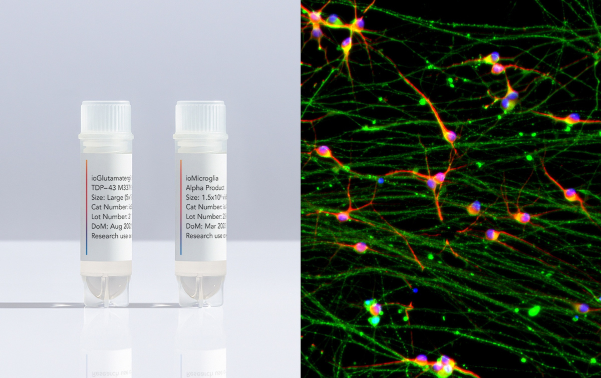 Press release | new cell products for neurodegenerative disease