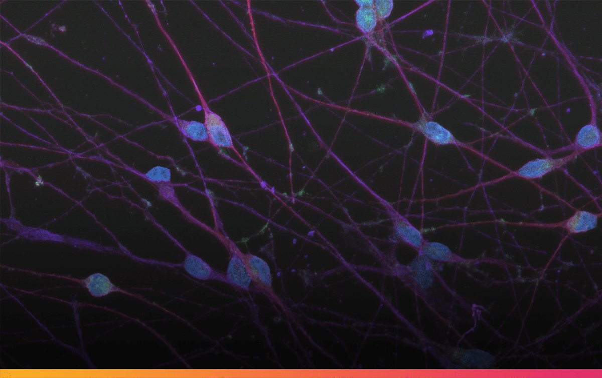Colour webinar with it.bio ioGlutamatergic Neurons_VGLUT2(G)_MAP2(R)_Tubb3(B)_Hoechst(B)_20x_merge-1