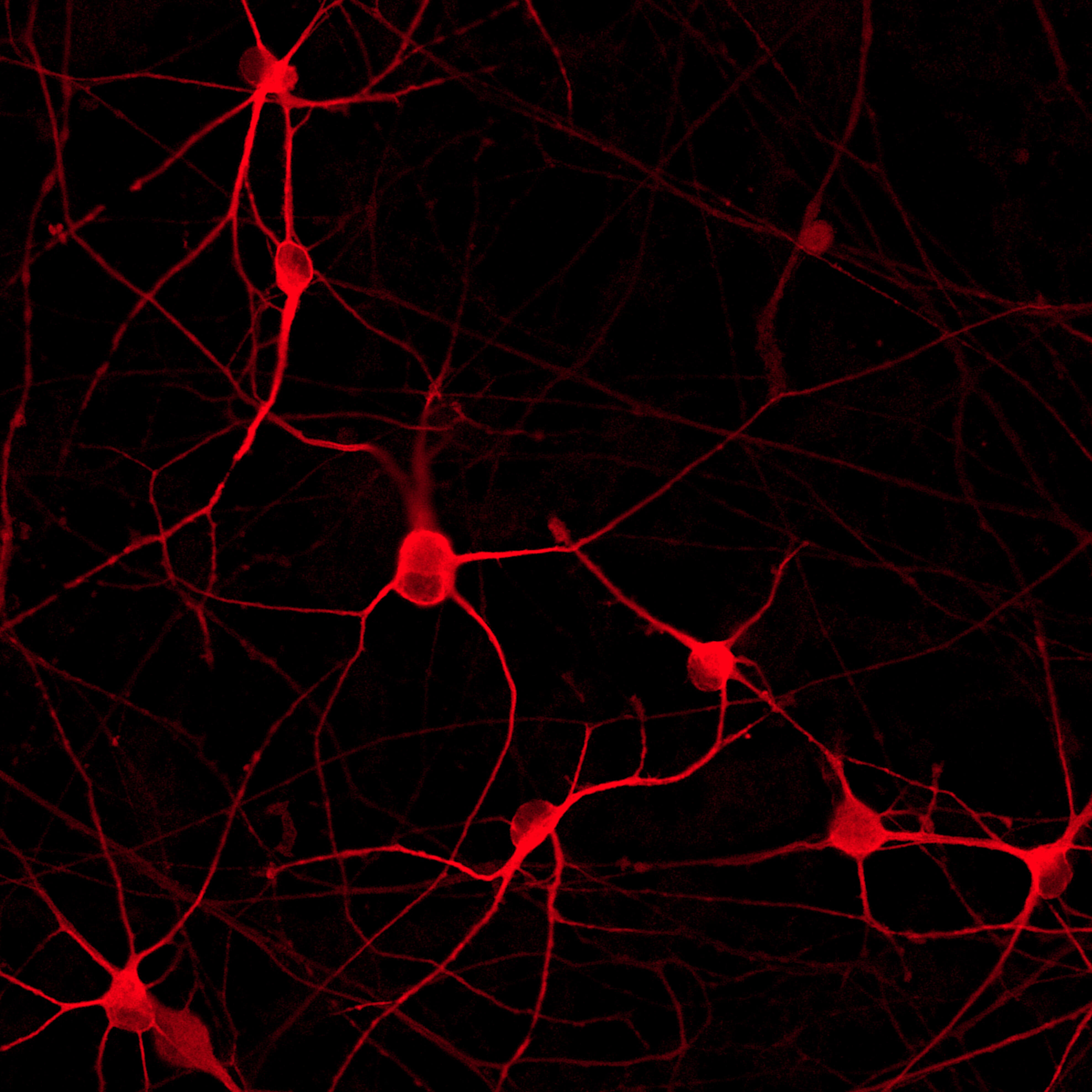 Product launch for our first disease model for studying Parkinson’s