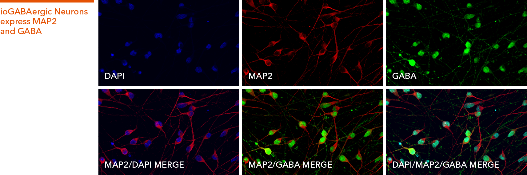Immunocytochemistry showing ioGABAergic Neurons express key markers GABA and MAP2