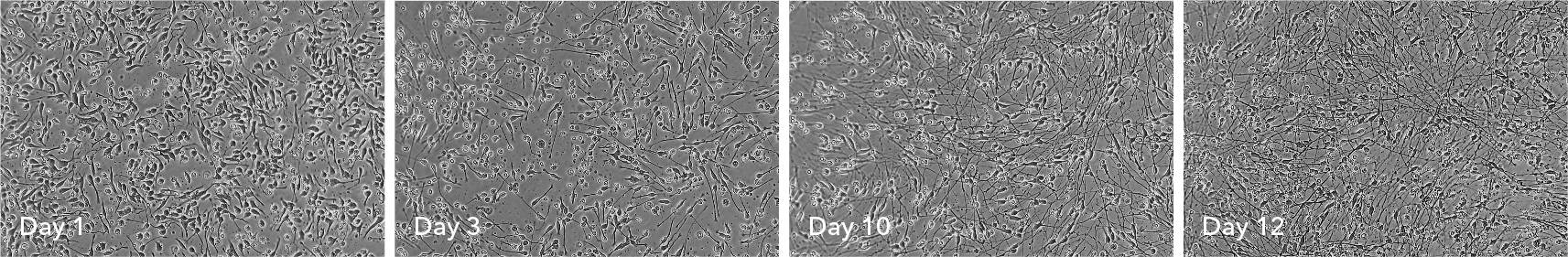 ioGABAergic neurons show neuronal networks by day 10, shown in a 12 day time course