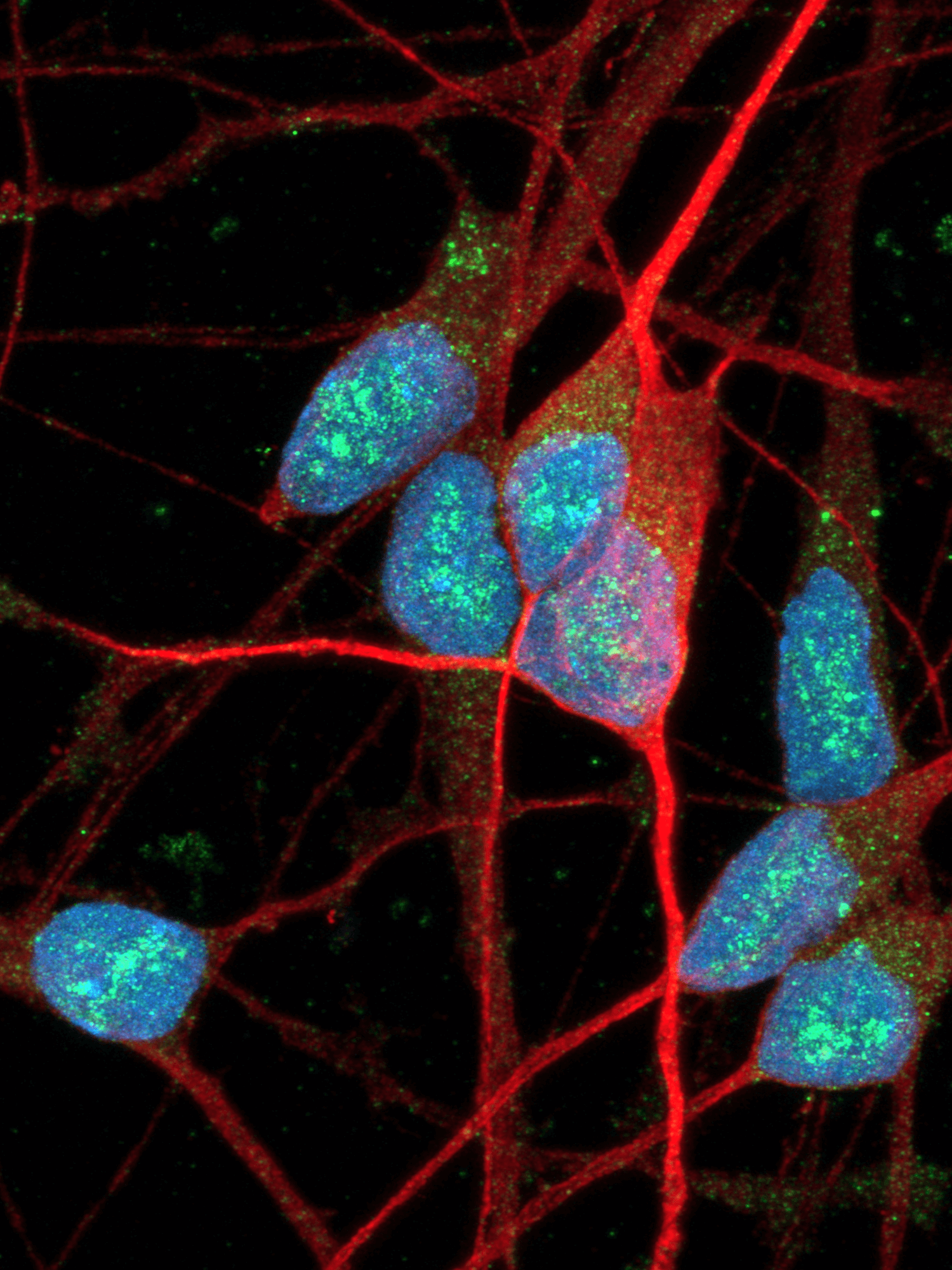 Immunocytochemistry staining of human iPSC-derived GABAergic neurons to identify, characterise, and validate in vitro.