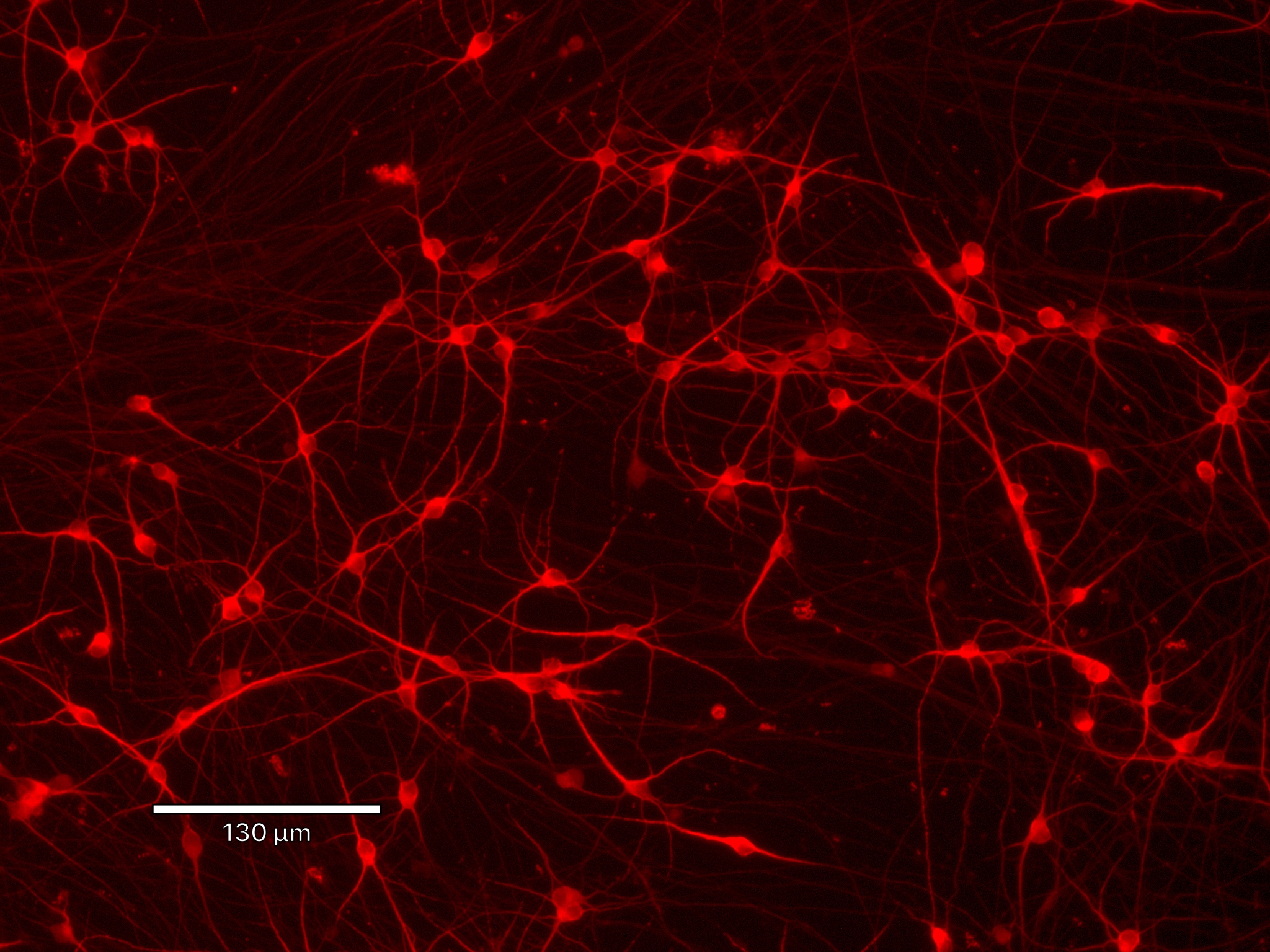 Product launch | CRISPR-Ready ioGlutamatergic Neurons