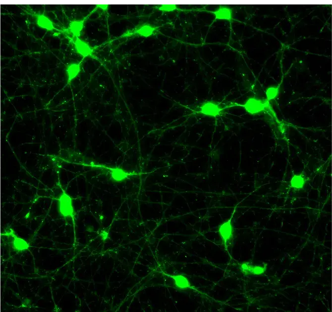 GFP Motor Neurons | ioCells