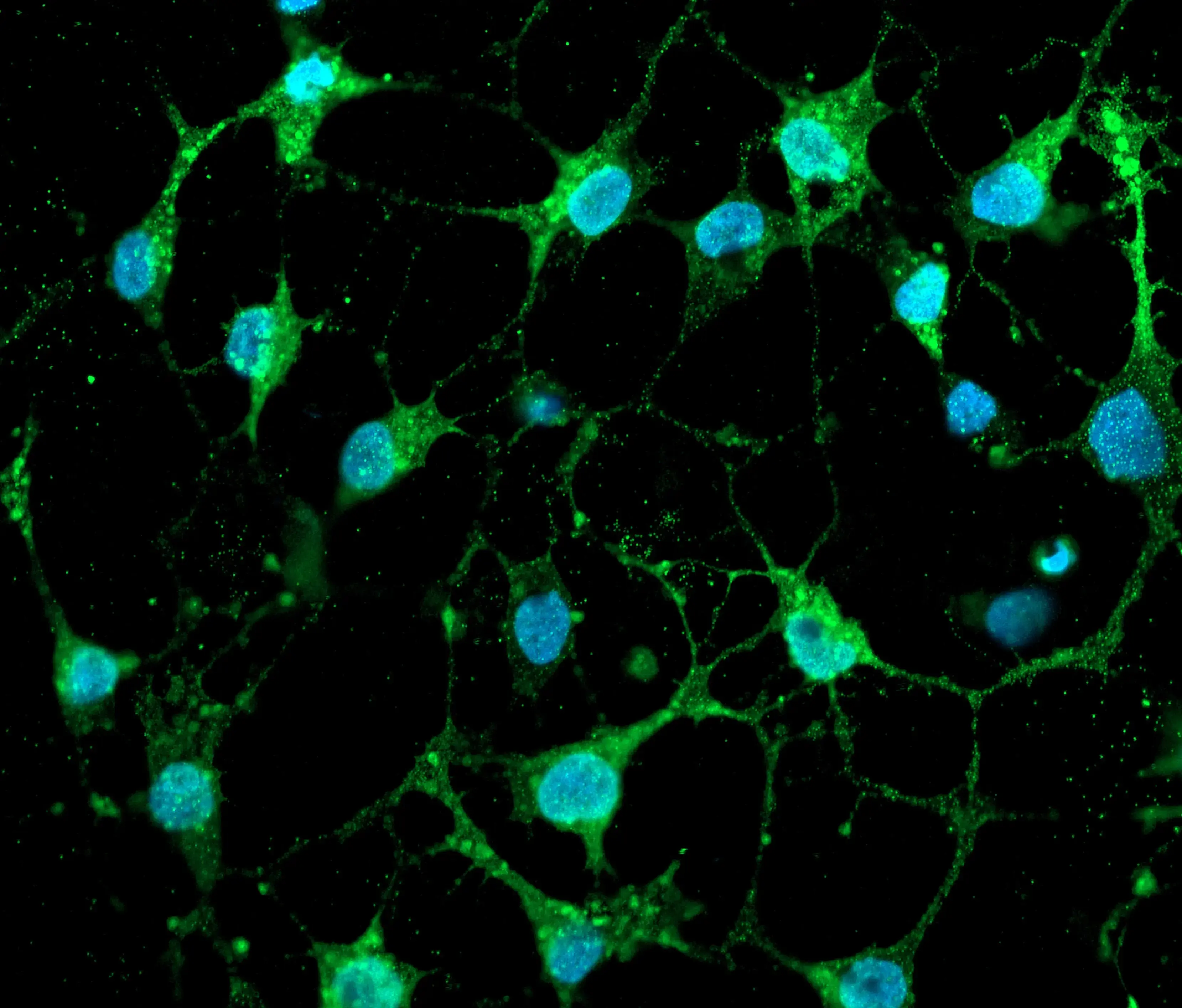 Human iPSC-derived OPC and oligodendrocyte-like cells | bit.bio