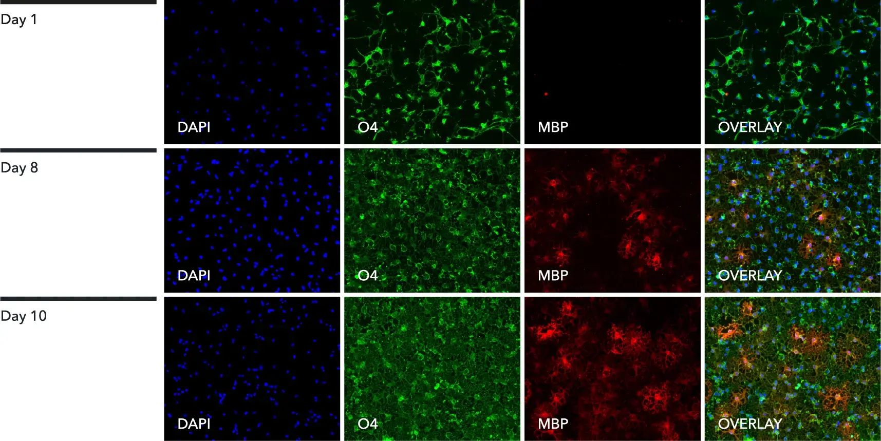Immunostaining panel for ioOligodendrocyte-like cells with DAPI, O4 and MBP.