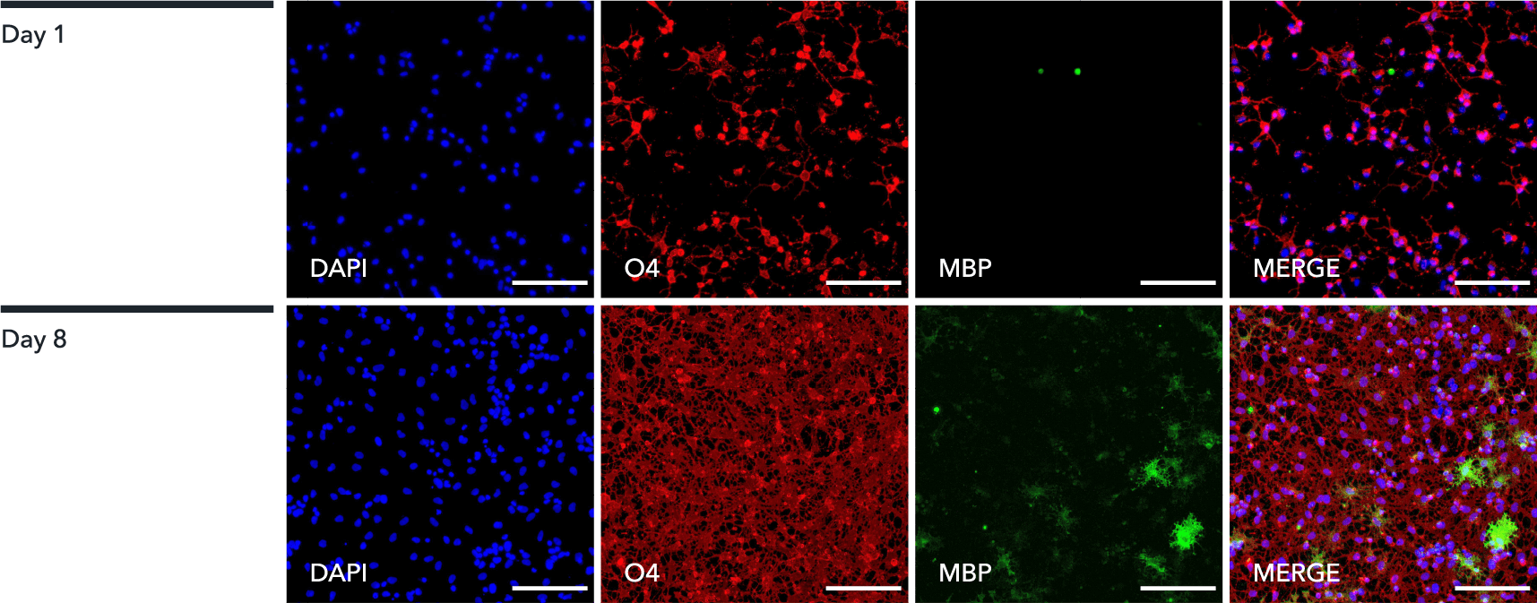 ioOligodendrocyte-like cells express key oligodendrocyte markers, O4 and MBP, showing an increased cell complexity from day 1 to day 8