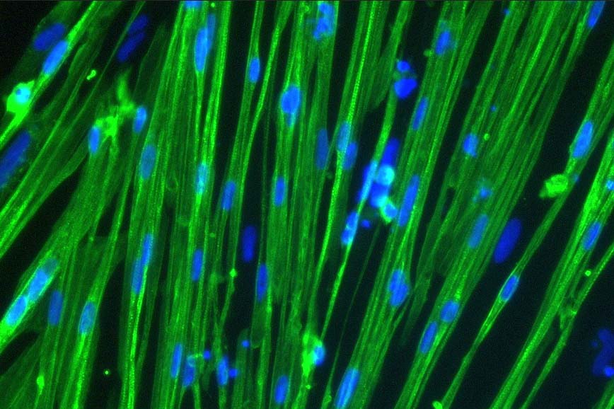 Immunocytochemistry staining of human iPSC-derived skeletal myocytes to identify, characterise, and validate in vitro.