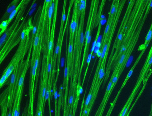 Human iPSC-derived ioSkeletal Myocytes