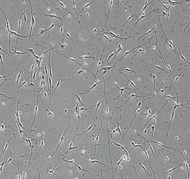 ioGlutamatergic Neurons TDP-43 M337V/WT brightfield day 1