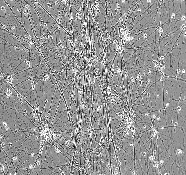 ioGlutamatergic Neurons TDP-43 M337V/WT brightfield day 11