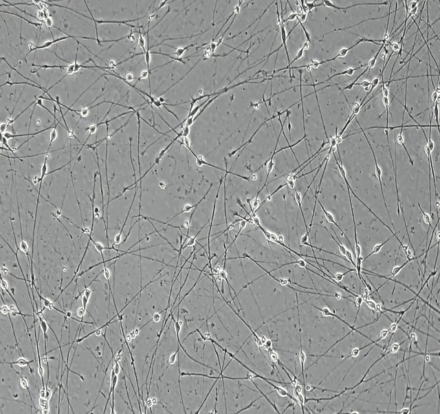ioGlutamatergic Neurons TDP-43 M337V/WT brightfield day 4
